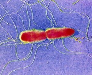 Salmonella Typhi