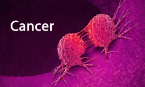 Cancer 